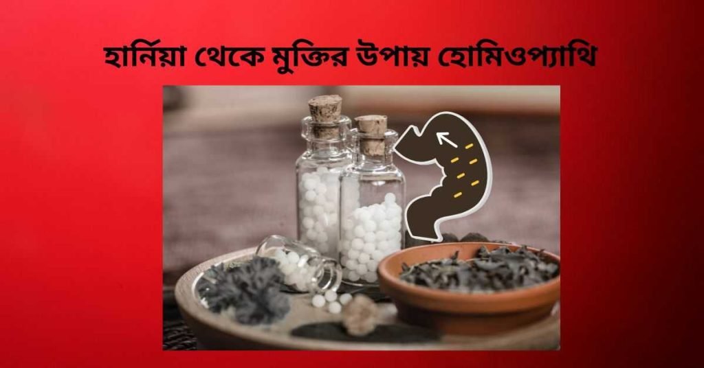 হার্নিয়া থেকে মুক্তির উপায় হোমিওপ্যাথি
