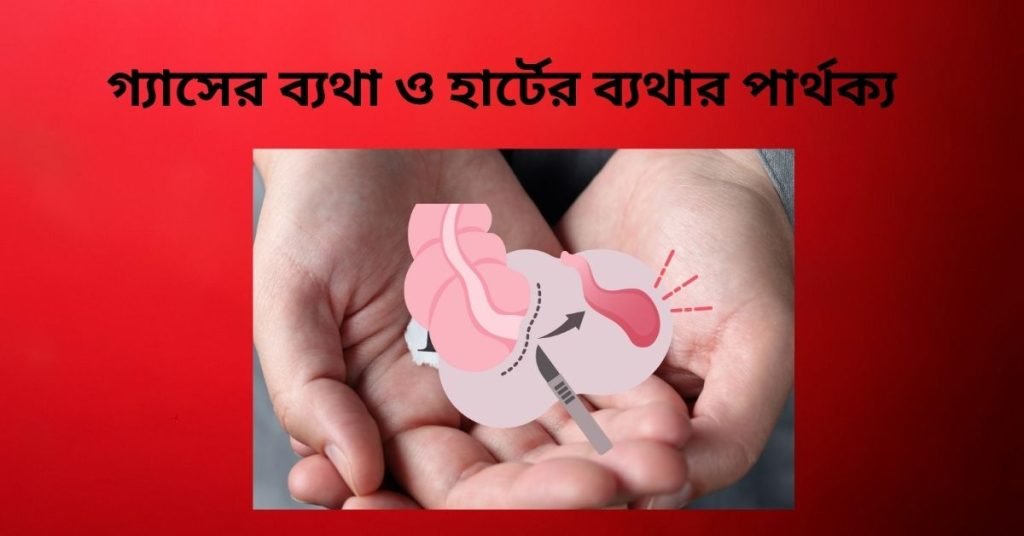 গ্যাসের ব্যথা ও হার্টের ব্যথার পার্থক্য