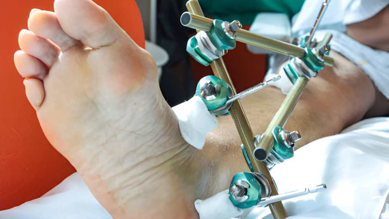 Understanding Wrist and Ankle Injuries